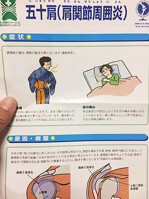 [写真]五十肩について書かれたちらし